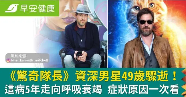 《驚奇隊長》資深男星突驟逝享年49歲！這病5年走向呼吸衰竭...症狀原因一次看