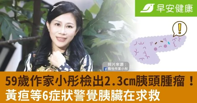 59歲作家小彤檢出2.3cm胰頭腫瘤！黃疸等6症狀警覺胰臟在求救