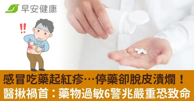 感冒吃藥起紅疹…停藥卻脫皮潰爛！醫揪禍首：藥物過敏6警兆嚴重恐致命