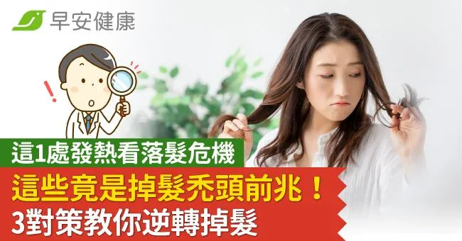 這些竟是提早掉髮禿頭前兆！1處發熱看落髮危機，3對策教你逆轉