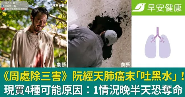 《周處除三害》阮經天肺癌末「吐黑水」！現實4種可能原因：1情況晚半天恐奪命