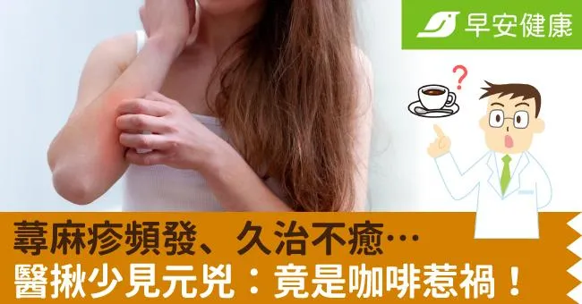 蕁麻疹頻發、久治不癒…醫揪少見元兇：竟是咖啡惹禍！