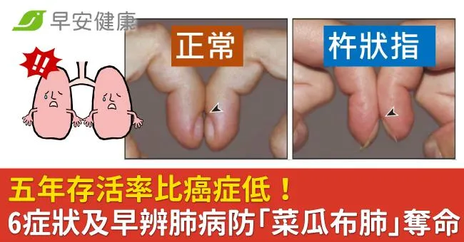 五年存活率比癌症低！6症狀及早辨肺病防「菜瓜布肺」奪命