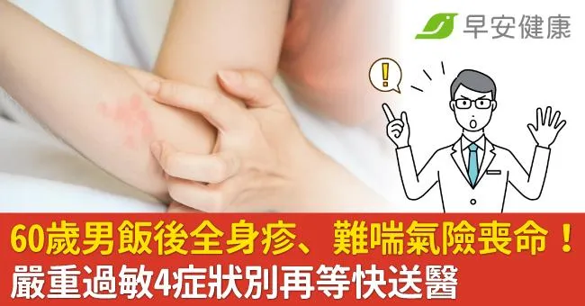 60歲男飯後全身冒紅疹、喘不過氣險喪命！嚴重過敏4症狀別再等快送醫