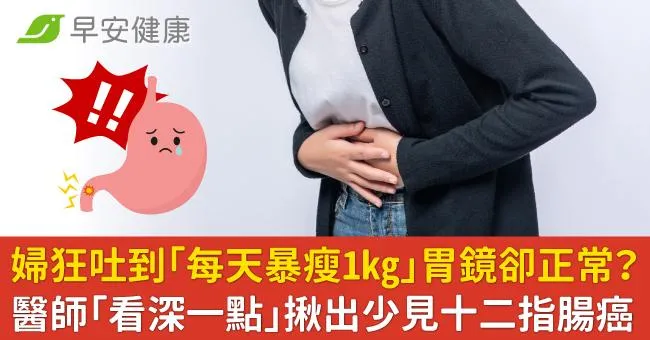 婦狂吐到「每天暴瘦1kg」胃鏡卻正常？醫師「看深一點」揪出少見十二指腸癌
