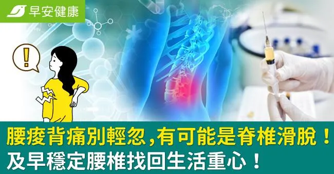 腰痠背痛別輕忽，有可能是脊椎滑脫！及早穩定腰椎找回生活重心！