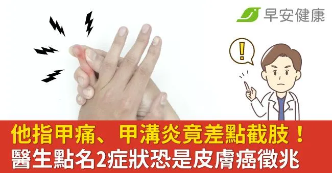 他指甲痛、甲溝炎竟差點截肢！醫生點名2症狀恐是皮膚癌徵兆