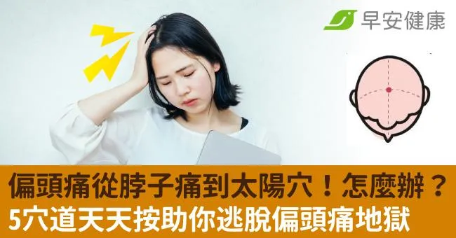 偏頭痛從脖子痛到太陽穴！怎麼辦？5穴道天天按助你逃脫偏頭痛地獄
