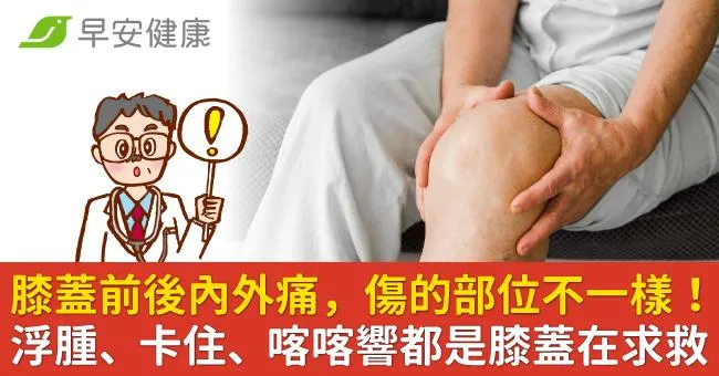 膝蓋前後內外痛，傷的部位不一樣！浮腫、卡住、喀喀響都是膝蓋在求救