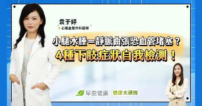 小腿水腫、浮腳筋＝靜脈曲張恐血管堵塞？醫師教你4種下肢症狀自我檢測！
