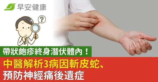 帶狀皰疹終身潛伏體內！中醫解析3病因斬皮蛇、預防神經痛後遺症