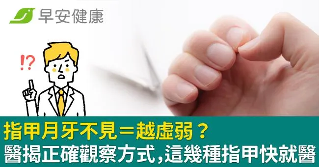指甲月牙不見＝越虛弱？醫揭正確觀察方式，這幾種指甲快就醫