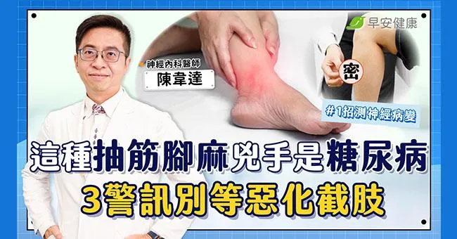 這種抽筋腳麻，幕後黑手是糖尿病！一招測神經病變風險別等惡化截肢