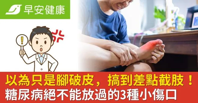 以為只是腳破皮，搞到差點截肢！糖尿病絕不能放過的3種小傷口