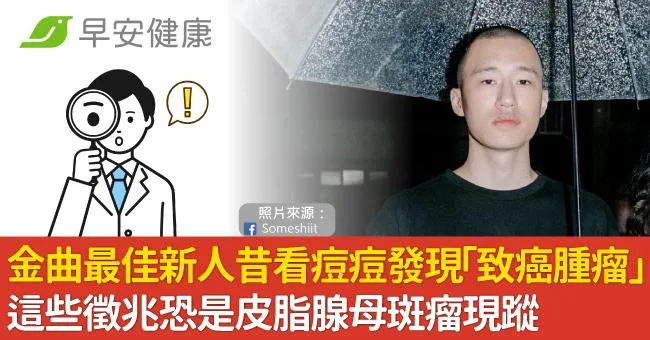 金曲最佳新人昔看痘痘發現「致癌腫瘤」這些徵兆恐是皮脂腺母斑瘤現蹤