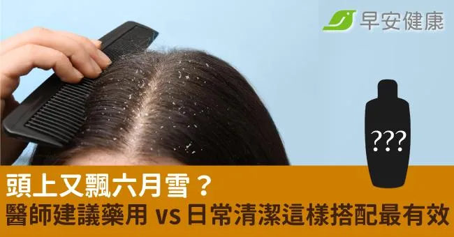 頭上又飄六月雪？醫師建議藥用 vs 日常清潔這樣搭配最有效