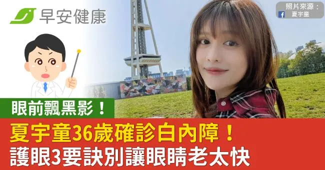 眼前飄黑影！夏宇童36歲確診白內障！護眼3要訣別讓眼睛老太快