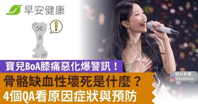 寶兒BoA膝痛惡化爆警訊！骨骼缺血性壞死是什麼？4個QA看原因症狀與預防