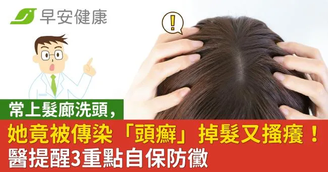 常上髮廊洗頭，她竟被傳染「頭癬」掉髮又搔癢！醫提醒3重點自保防黴