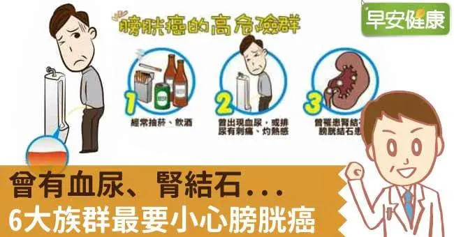 曾有血尿、腎結石...6大族群最要小心膀胱癌