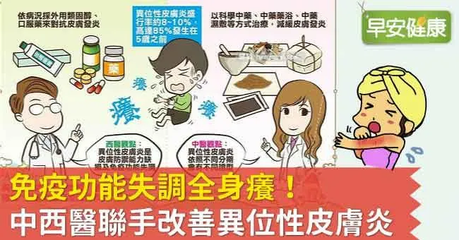免疫功能失調全身癢！中西醫聯手改善異位性皮膚炎