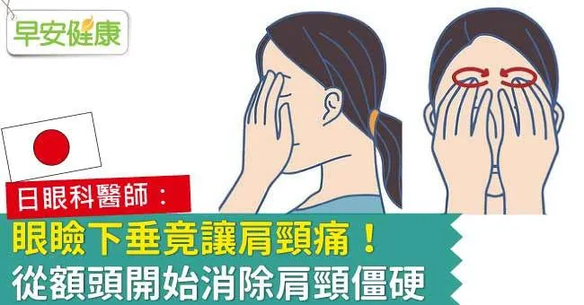 眼瞼下垂竟讓肩頸痛！從額頭開始消除肩頸僵硬
