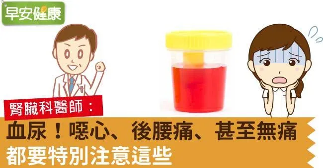 血尿！噁心、後腰痛、甚至無痛，都要特別注意這些