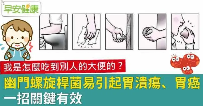 幽門螺旋桿菌易引起胃潰瘍、胃癌，一招關鍵有效
