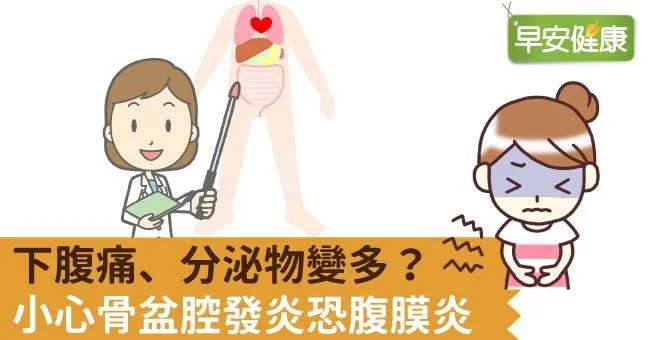 下腹痛、分泌物變多？小心骨盆腔發炎恐腹膜炎