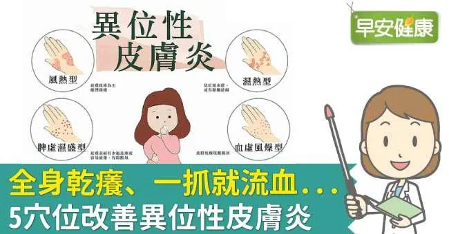 全身乾癢、一抓就流血...5穴位改善異位性皮膚炎