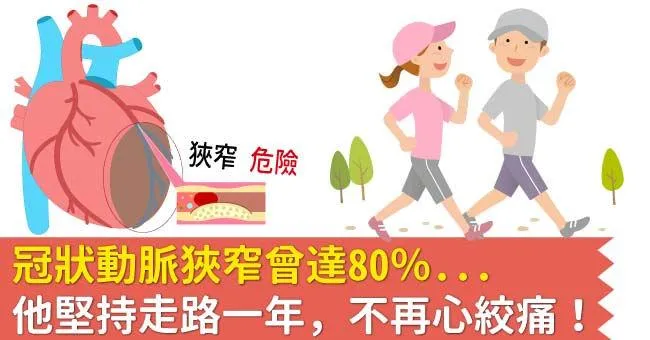 冠狀動脈狹窄曾達80％...他堅持走路一年，不再心絞痛！