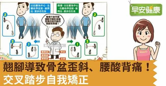 翹腳導致骨盆歪斜、腰酸背痛！交叉踏步自我矯正