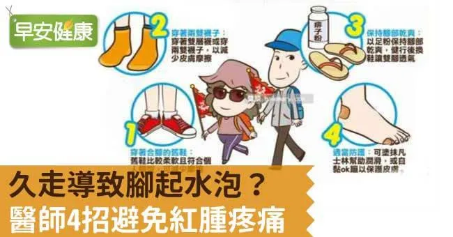 腳起水泡，可以自己戳破嗎？預防水泡，醫師4招遠離紅腫痛
