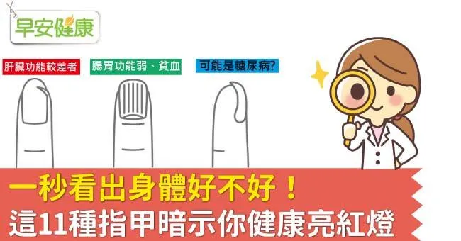 一秒看出身體好不好！這11種指甲暗示你健康亮紅燈