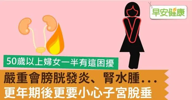 嚴重會膀胱發炎、腎水腫...更年期後更要小心子宮脫垂