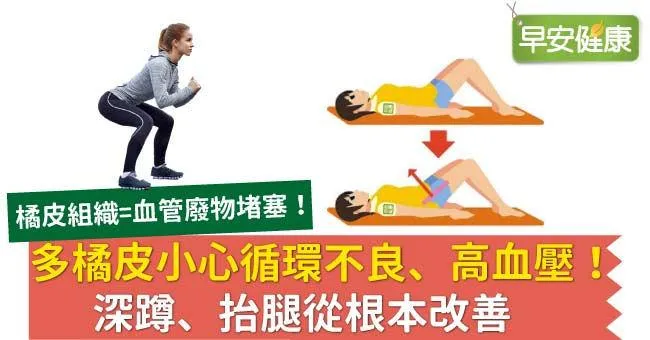 多橘皮小心循環不良、高血壓！深蹲、抬腿從根本改善