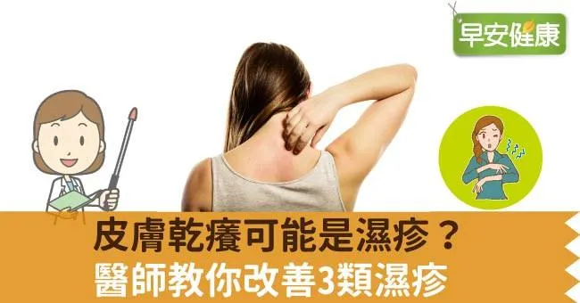 皮膚乾癢可能是濕疹？醫師教你改善3類濕疹