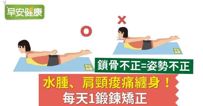 鎖骨不正​=姿勢不正​，​水腫、肩頸痠痛纏身！每天1鍛鍊矯正