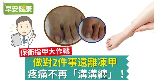 做對2件事遠離凍甲，疼痛不再「溝溝纏」！