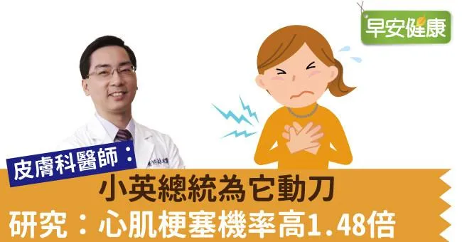 小英總統為它動刀，研究：心肌梗塞機率高1.48倍