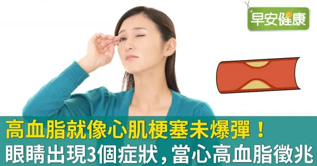 高血脂就像心肌梗塞未爆彈！眼睛出現3個症狀，當心高血脂徵兆