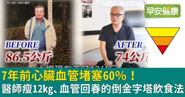 7年前心臟血管堵塞60％！醫師瘦12kg、血管回春的倒金字塔飲食法