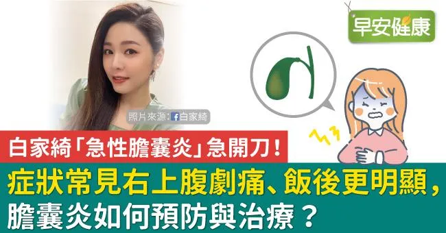 白家綺「急性膽囊炎」急開刀！膽囊炎常右上腹劇痛、飯後更明顯，如何預防與治療？
