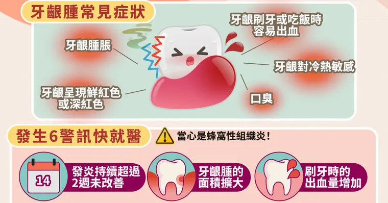 牙齦腫會自己好嗎？牙齦發炎9大原因、症狀與快速消腫法