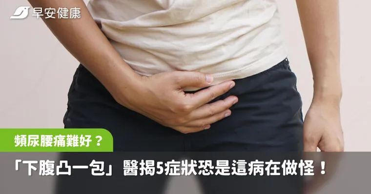 頻尿腰痛好不了？「下腹凸一包」醫揭這5症狀恐是這病在做怪！