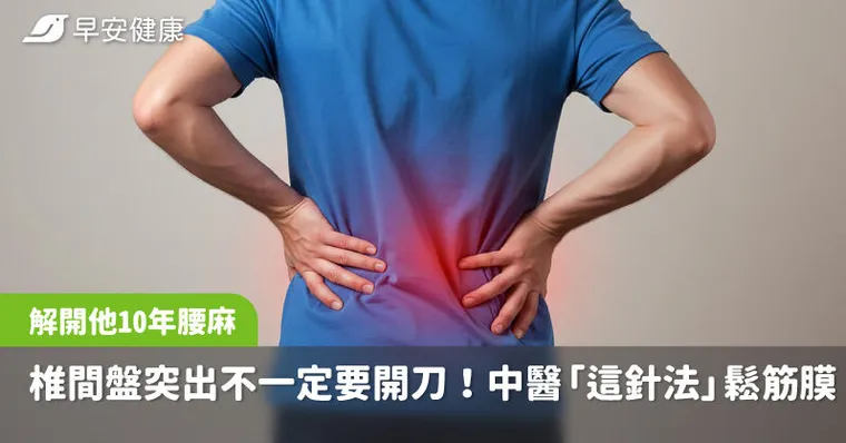 椎間盤突出不一定要開刀！中醫「這針法」鬆筋膜、調脊椎，解他10年腰麻腳痛