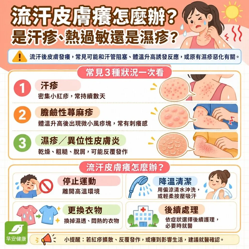 流汗皮膚癢怎麼辦？擦什麼藥？汗疹蕁麻疹快篩、藥膏與防癢指南