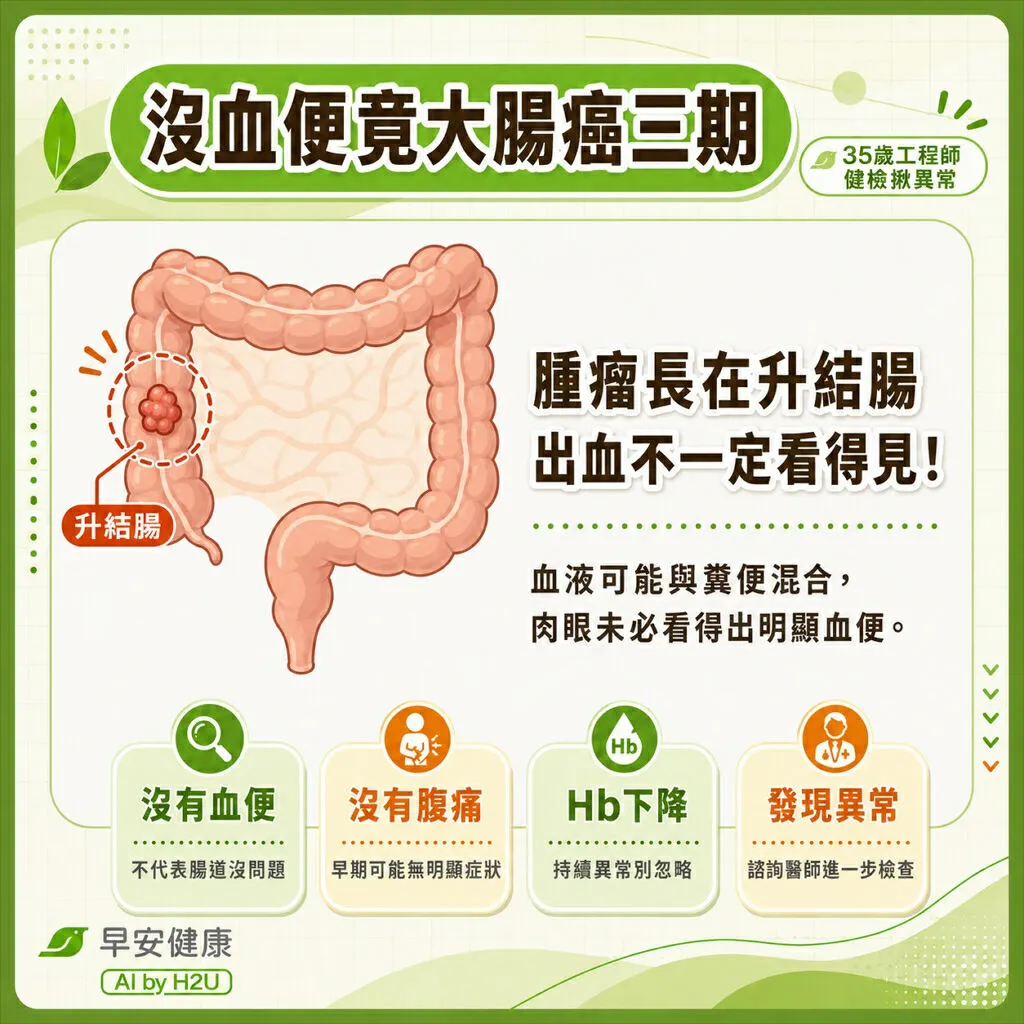 沒血便竟已大腸癌三期！35歲工程師健檢一指數降，驚覺升結腸腫瘤