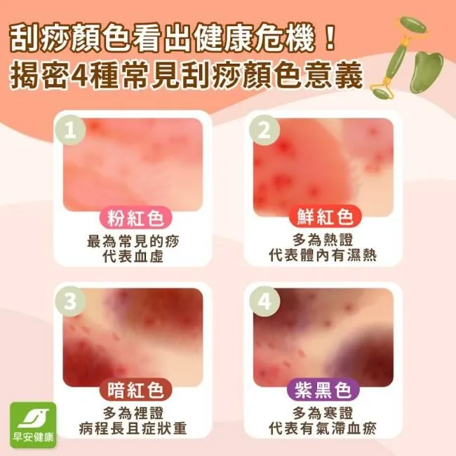 早安健康_刮痧顏色看健康危機