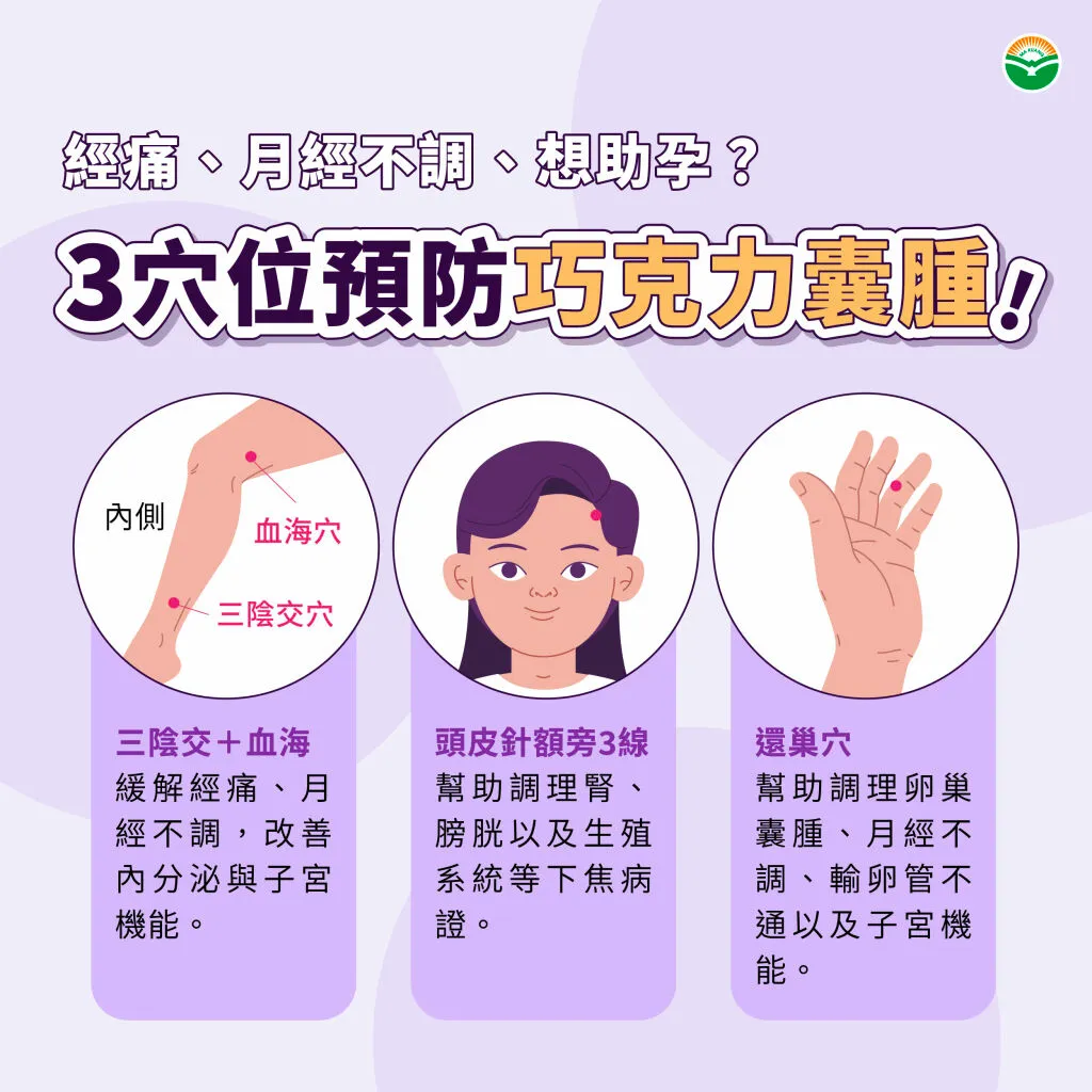 馬光中醫_巧克力囊腫穴位